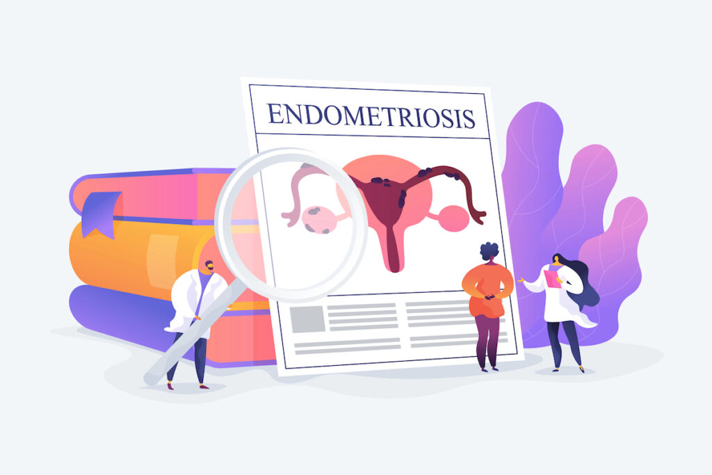 Endometriosis Specialist in Tysons Corner