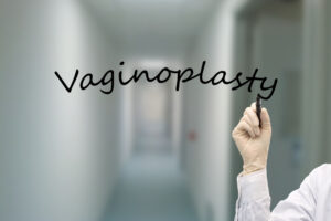 Vaginoplasty Consultation in Tysons, Virginia: Cost, Recovery, and Candidacy