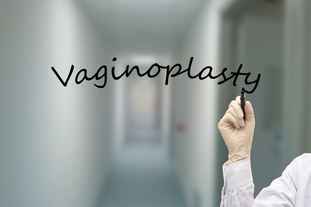 Vaginoplasty Consultation in Tysons, Virginia: Cost, Recovery, and Candidacy