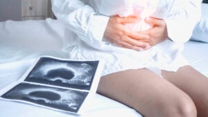 Ovarian Cyst Pain Near Woodbridge, Virginia: Urgent GYN Evaluation